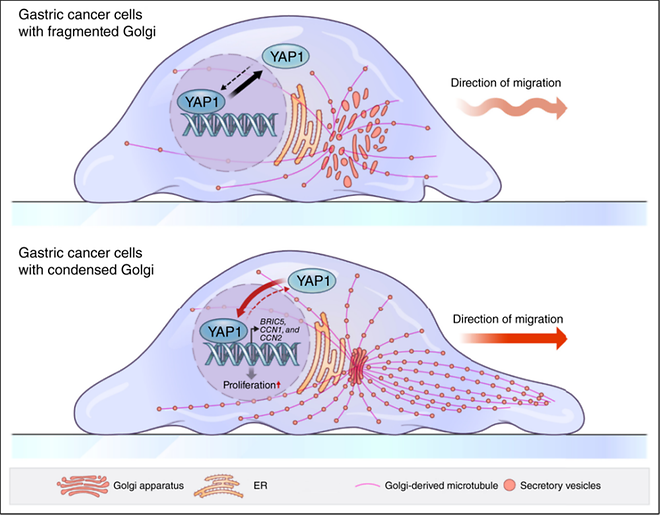 Kim Ji-yoon’s Team Identifies Golgi Apparatus “Condensation” as a Key Driver of Gastric Cancer Progr