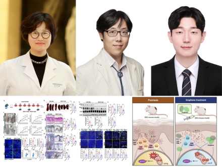 Prof. Mi-La Cho’s Team: Nanoparticle Strategy for Recurrent Psoriasis Treatment